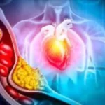 كنز طبي في كل منزل.. طعام بسيط ينهي أزمة الكوليسترول دون أدوية كيميائية#كنز #طبي #في #كل #منزل. #طعام #بسيط #ينهي #أزمة #الكوليسترول #دون #أدوية #كيميائية