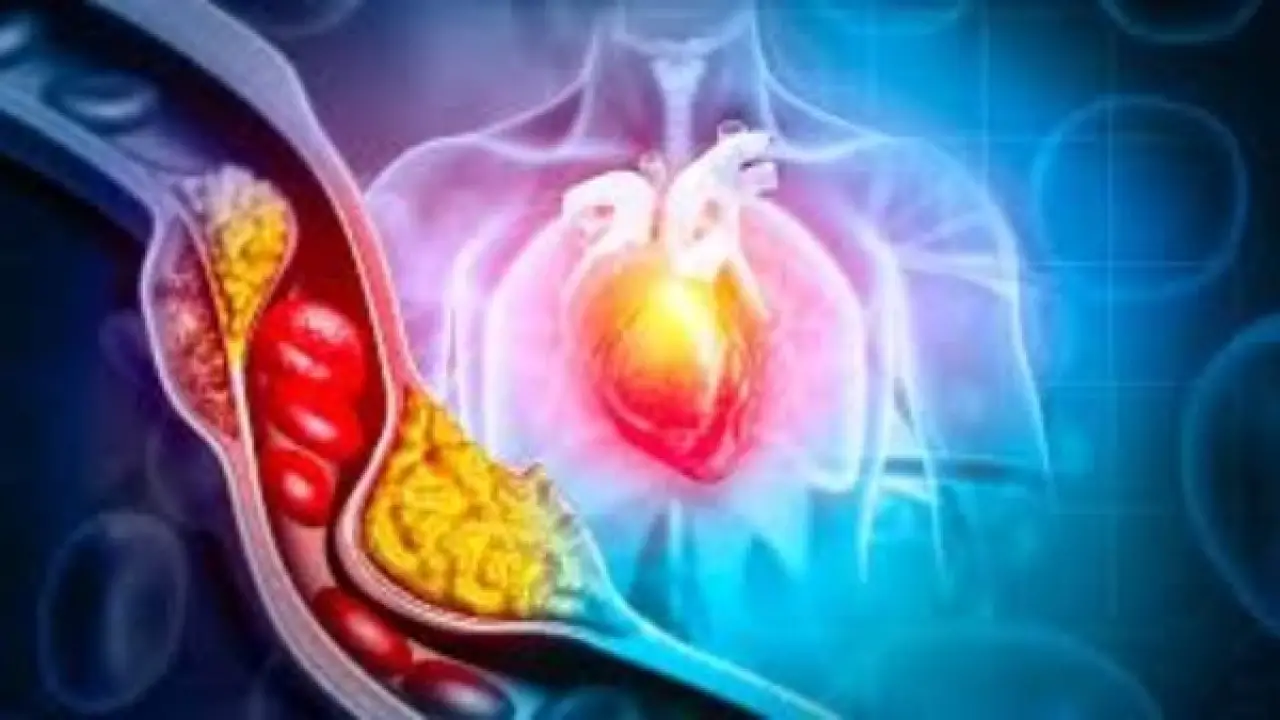 كنز طبي في كل منزل.. طعام بسيط ينهي أزمة الكوليسترول دون أدوية كيميائية#كنز #طبي #في #كل #منزل. #طعام #بسيط #ينهي #أزمة #الكوليسترول #دون #أدوية #كيميائية