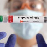 لمواجهة "جدري القرود".. الكاميرون تعلن حالة التأهب القصوى وتفعل أنظمة المراقبة الوبائية#لمواجهة #جدري #القرود. #الكاميرون #تعلن #حالة #التأهب #القصوى #وتفعل #أنظمة #المراقبة #الوبائية