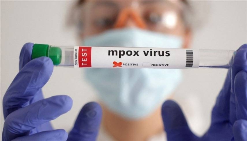 لمواجهة "جدري القرود".. الكاميرون تعلن حالة التأهب القصوى وتفعل أنظمة المراقبة الوبائية#لمواجهة #جدري #القرود. #الكاميرون #تعلن #حالة #التأهب #القصوى #وتفعل #أنظمة #المراقبة #الوبائية