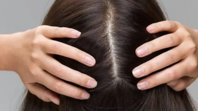 وداعاً للإحراج.. سر طبي بسيط ينهي أزمة قشرة الشعر المزمنة للأبد#وداعا #للإحراج. #سر #طبي #بسيط #ينهي #أزمة #قشرة #الشعر #المزمنة #للأبد